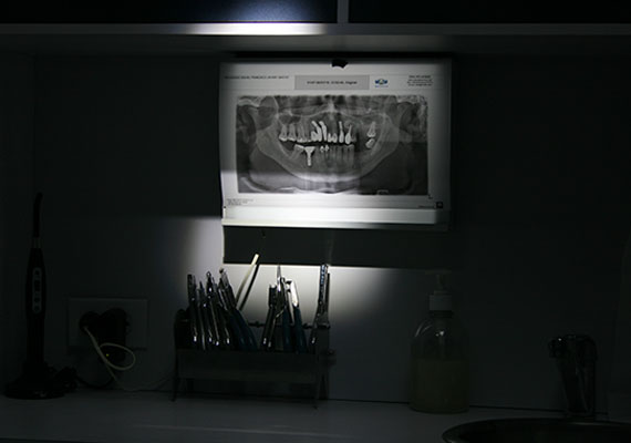 nosotros, arrfox, atencion dental, clinica dental, dentista