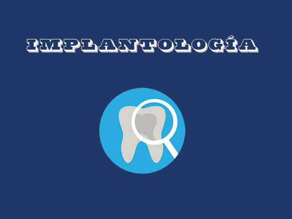 implantología, clínica dental, arrfox, condesa, cdmx
