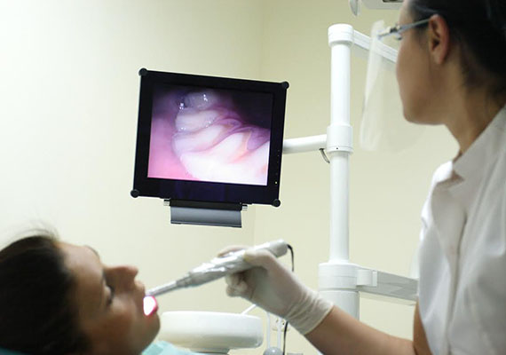 tecnologia, arrfox, camara intraoral, dentista, clinica dental, cdmx, condesa
