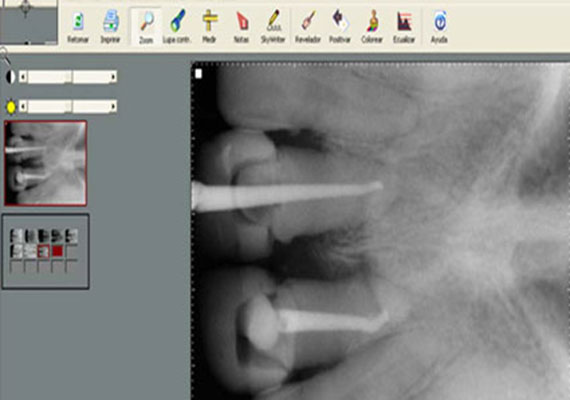 tecnologia, arrfox, radiologia digital, dentista, clinica dental, cdmx, condesa