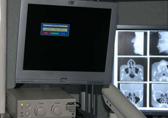 tecnologia, arrfox, sistema ultrasonido, dentista, clinica dental, cdmx, condesa
